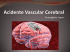 Acidente Vascular Cerebral